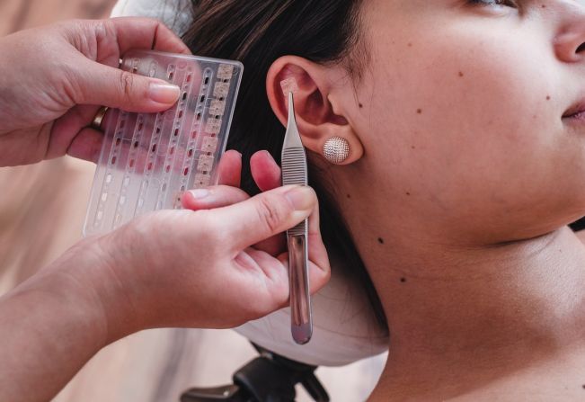 Saúde disponibiliza atendimentos de auriculoterapia