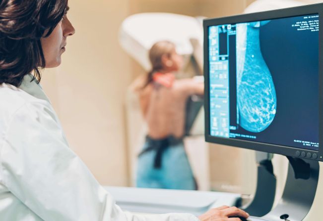 Saúde disponibiliza transporte para realização de mamografias