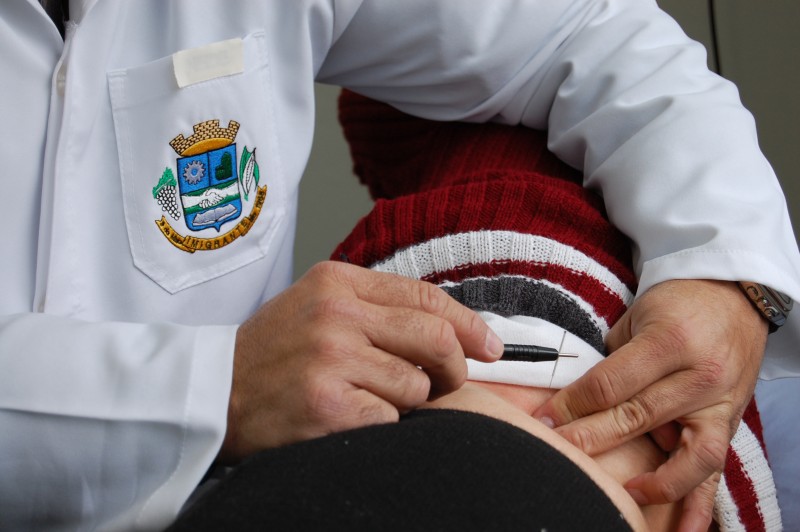 Centro de Saúde passa a oferecer acupunturas